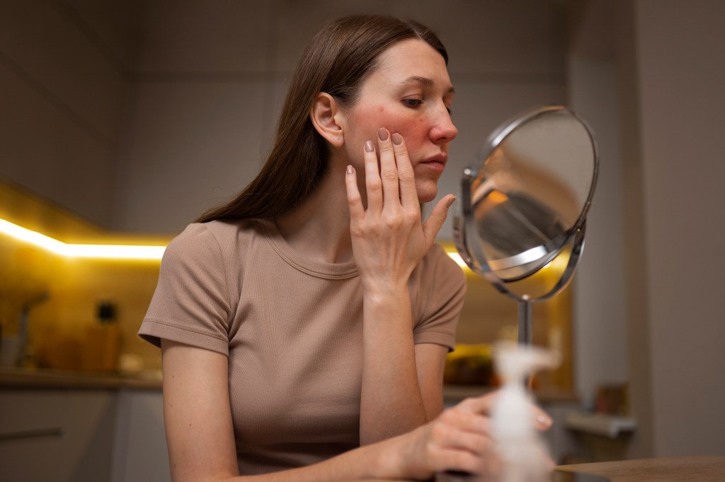 Why You Should Avoid OTC Medicated&nbsp;Creams