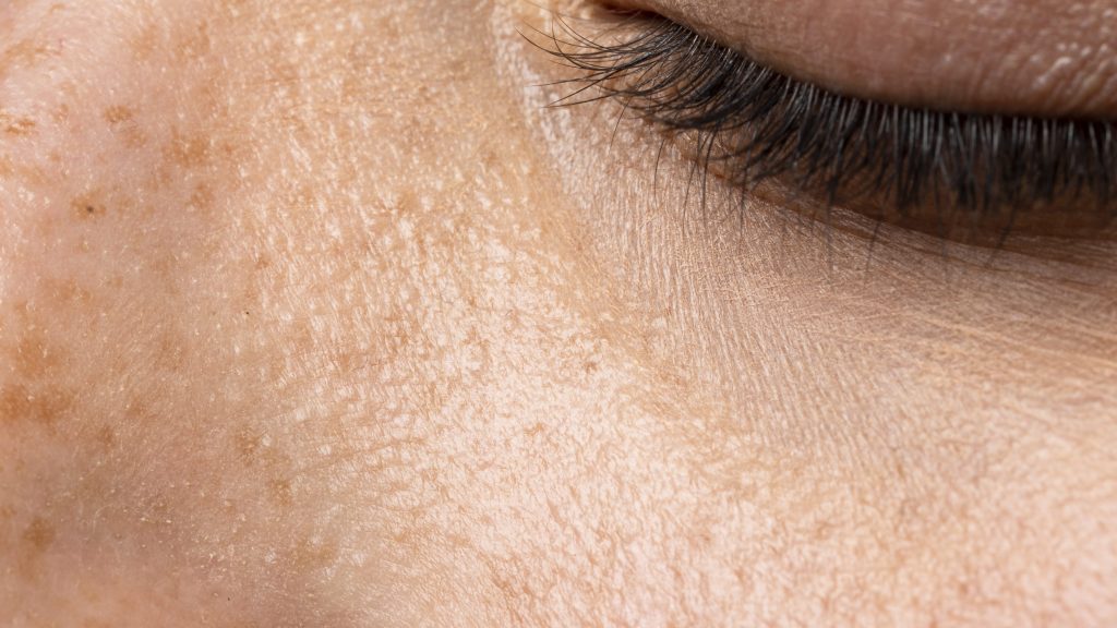 Minimise Pores with Safe Skincare&nbsp;Routine